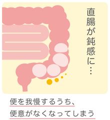 直腸性便秘