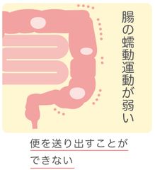 弛緩性便秘