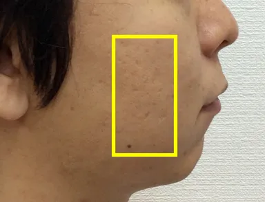 測定エリア 顔1
