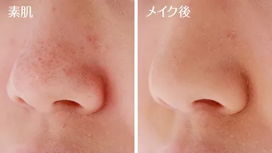 【Case2-3】毛穴がキレイにカバーできました。