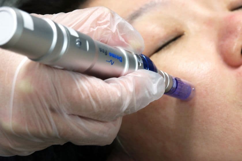 シロノクリニック、たるみ専門外来に再生医療技術の新処方
ヒト幹細胞培養液に5種の成長因子をMIXした
「5GFヴァージンエッセンススペシャル」
8月提供開始からインバウンド好調